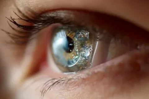 Brain-Stimulating Contact Lenses Match Prozac in Depression Study