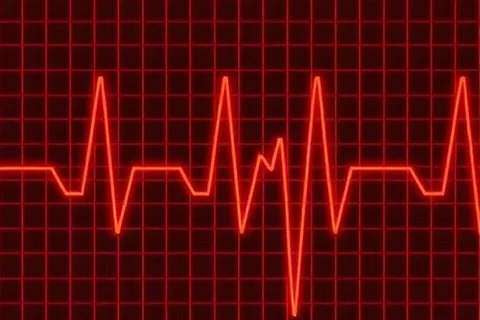 Deep Learning Reveals ECG Sudden Death Marker