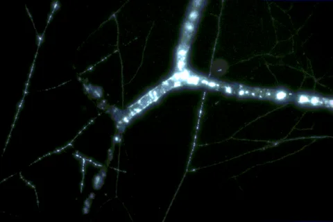 Hidden Web of Fungus Inside Earth Could Reach The Sun a Billion Times