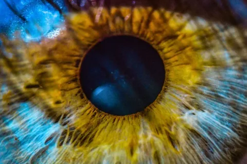 A Signal of Future Alzheimer's May Be Hidden in Your Eyes