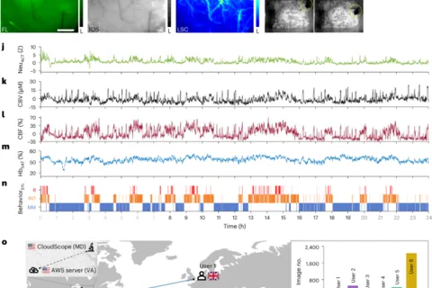 A cloud-based miniscope for neurosurveillance of brain health and disease in freely behaving animals